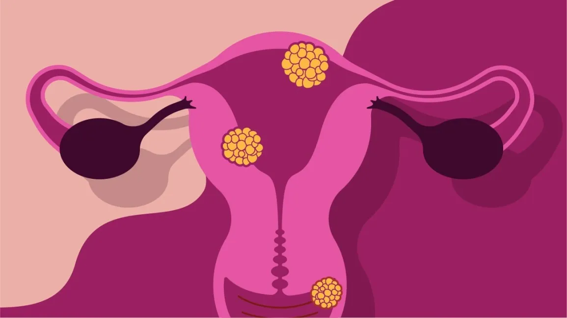 colorful photo of women reproductive 